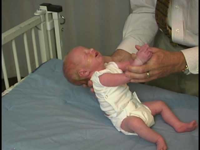 Neurologic Exam-Pediatric | Newborn | Abnormal | Tone Head Lag