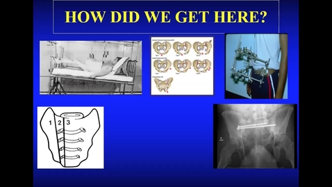 Thumbnail for 08/05/22 | David Templeman, MD: The Evolution of Pelvic Surgery