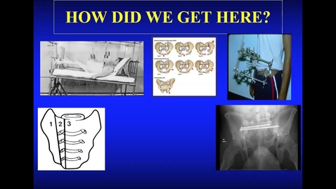 Thumbnail for entry 08/05/22 | David Templeman, MD: The Evolution of Pelvic Surgery