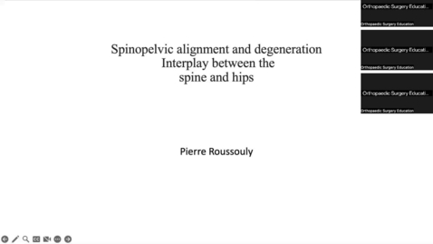 Thumbnail for entry 04/28/23 | Pierre Roussouly, MD: Degenerative Evolution of Normal Sagittal Spino-Pelvic Alignment: How to Use it for Strategy of Surgical Reduction in Spinal Deformities