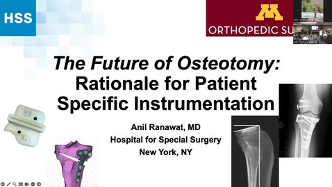 Thumbnail for 02/13/25 | Anil Ranawat, MD: The Future of Osteotomy — Rationale for Patient Specific Instrumentation