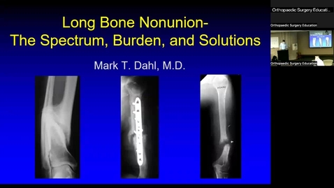 Thumbnail for entry 10/28/22 | Mark Dahl, MD: Long Bone Nonunion — The Spectrum, Burden, &amp; Solutions