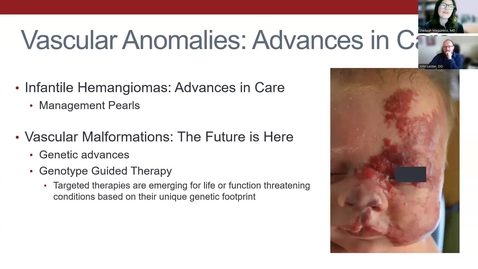 Thumbnail for &quot;Vascular Anomalies, Advances in Care&quot; with Siobhan Flanagan, MD; Luke Jakubowski, MD; Sheilagh Maguiness, MD; Nishitha Pillai, MBBS