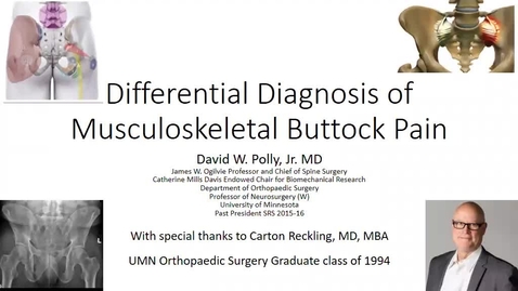 Thumbnail for entry 10/21/22 | David Polly, MD: Differential Diagnosis of Buttock Pain for the Orthopedic Surgeon