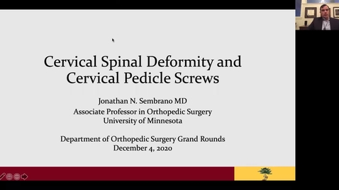 Thumbnail for entry 12/04/20 | Jonathan Sembrano, MD: Cervical Spine Deformity and Cervical Pedicle Screws